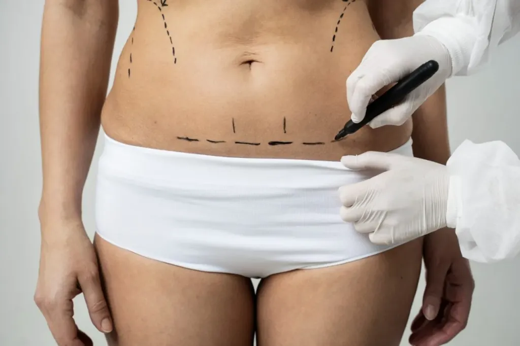 Jak przebiega szkolenie z liposukcji strzykawkowej?